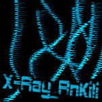 X-Ray_AnKiIi